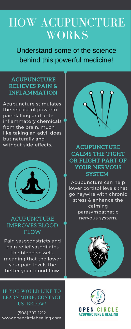 All Categories Open Circle Acupuncture And Healing